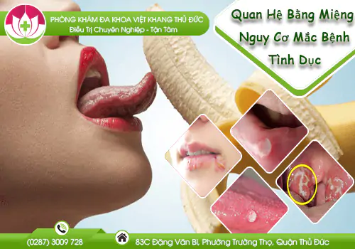 quan-he-bang-mieng-nguy-co-mac-benh-tinh-duc-1020