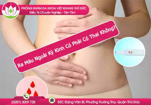ra-mau-ngoai-ky-kinh-co-phai-co-thai-khong-906