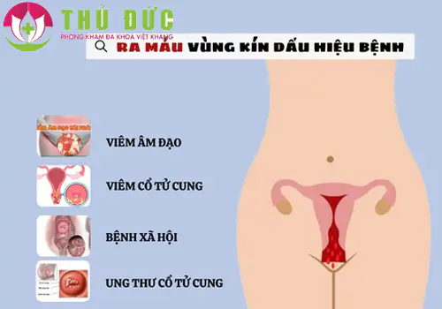 ra-mau-vung-kin-dau-hieu-canh-bao-benh-ly-nguy-hiem-1233