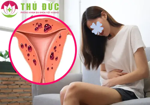 Ra máu vùng kín dấu hiệu cảnh báo bệnh viêm vùng chậu