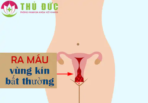 Ra máu vùng kín bất thường vấn đề nữ giới cần lưu ý