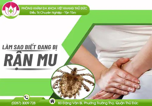 lam-sao-biet-dang-bi-ran-mu-37