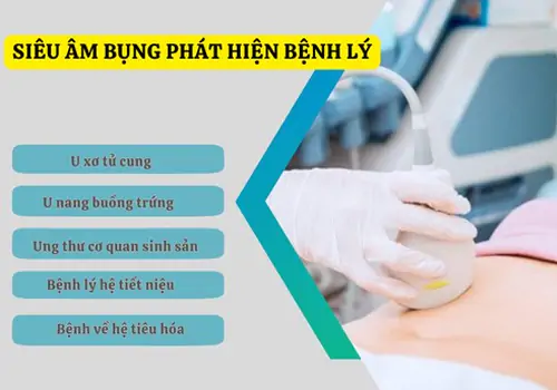 sieu-am-bung-phat-hien-benh-gi-va-nhung-dieu-can-biet-1142