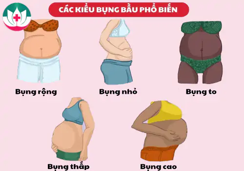 Phân biệt thêm các dạng bụng bầu thường gặp