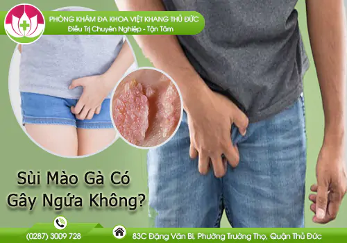 sui-mao-ga-co-gay-ngua-khong-924