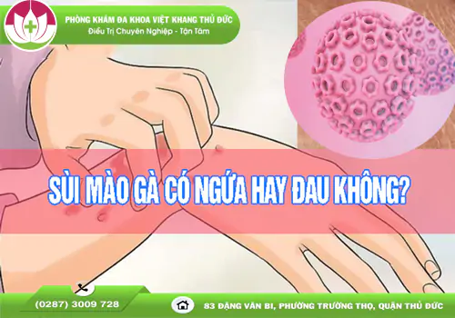 sui-mao-ga-co-ngua-khong-khi-nao-can-di-kham-ngay-2058