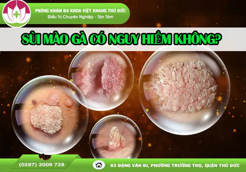sui-mao-ga-co-nguy-hiem-khong-canh-bao-bien-chung-kho-luong-2057