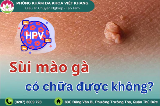 sui-mao-ga-co-tri-duoc-khong-phuong-phap-chua-va-dia-chi-uy-tin-1700