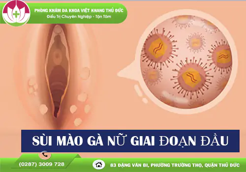 sui-mao-ga-nu-giai-doan-dau-nhan-biet-som-de-dieu-tri-hieu-qua-2152