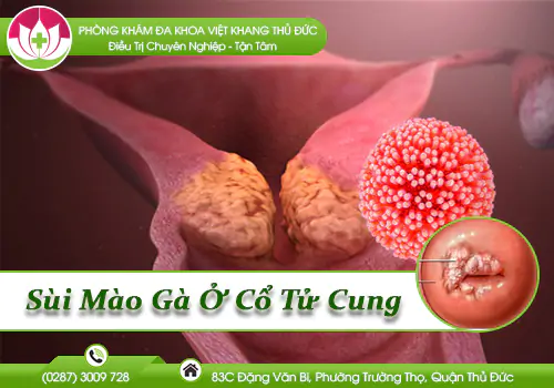 sui-mao-o-co-tu-cung-nhu-the-nao-va-cach-dieu-tri-ra-sao-1076