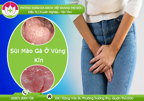 sui-mao-ga-o-vung-kin-va-cach-ho-tro-dieu-tri-hieu-qua-1049