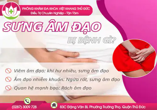 sung-am-dao-do-dau-cach-chua-nhu-the-nao-178