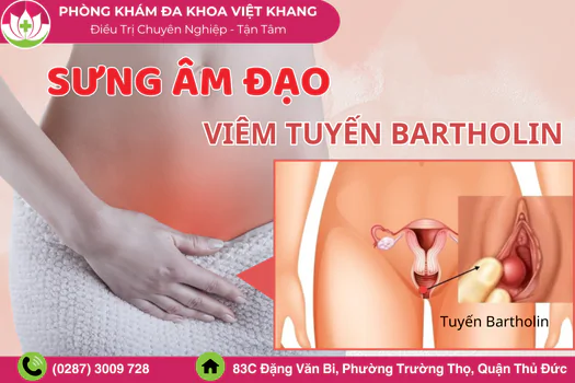 sung-am-dao-canh-bao-nguy-co-viem-nang-tuyen-bartholin-1581