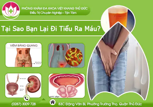 tai-sao-ban-lai-di-tieu-ra-mau-doi-tuong-nao-hay-mac-phai-959