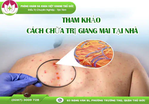 tham-khao-4-cach-chua-tri-giang-mai-tai-nha-2005