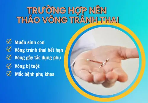 Điểm qua các trường hợp nên tháo vòng tránh thai
