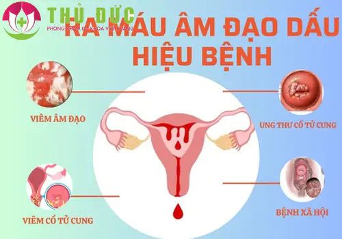 thu-pham-gay-ra-mau-am-dao-bat-thuong-o-nu-gioi-1232