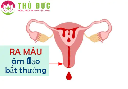 Chảy máu âm đạo bất thường vấn đề nữ giới cần lưu ý