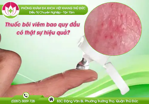 thuoc-boi-viem-bao-quy-dau-co-that-su-hieu-qua-515