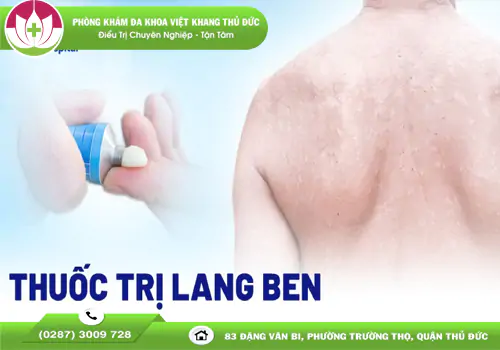 thuoc-tri-lang-ben-giai-phap-nhanh-chong-an-toan-2075