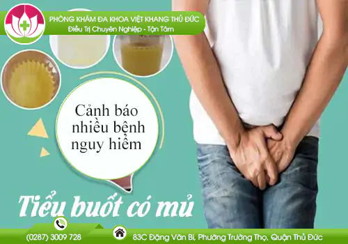 tieu-buot-co-mu---can-benh-nguy-hiem-khong-nen-bo-qua-593