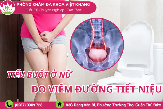 nguyen-nhan-tieu-buot-o-nu-cach-khac-phuc-tieu-buot-nhanh-1314