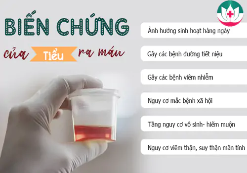 Đi tiểu ra máu nguy hiểm như thế nào?