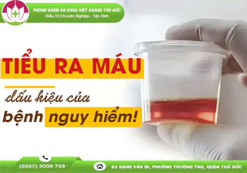 Tìm hiểu tiểu ra máu cảnh báo bệnh gì?