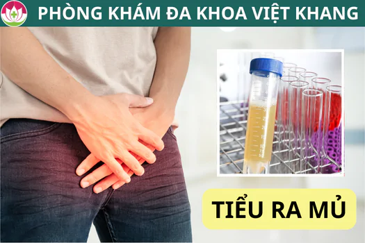 tieu-co-mu-dau-hieu-canh-bao-benh-nguy-hiem-khong-nen-bo-qua-1284