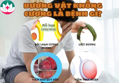 tim-hieu-duong-vat-khong-cuong-la-benh-gi-1190