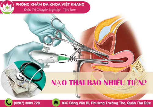 tim-hieu-nao-thai-bao-nhieu-tien-tai-co-so-y-te-uy-tin-1707