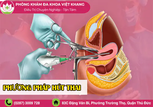 tim-hieu-phuong-phap-hut-thai-an-toan-khong-dau-2122
