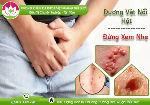 tim-hieu-thong-tin-khi-duong-vat-noi-hot-980