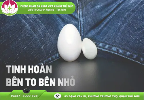 tinh-hoan-1-ben-to-ben-nho-lieu-co-dang-lo-ngai-2092