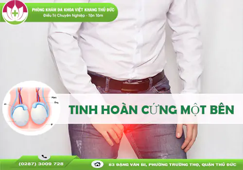 tinh-hoan-cung-mot-ben-co-nguy-hiem-khong-dung-chu-quan-1599