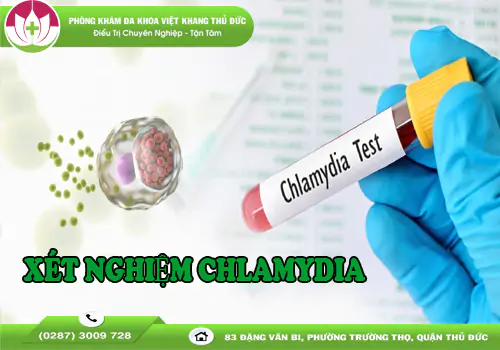 tong-hop-cach-xet-nghiem-chlamydia-va-bang-gia-chi-tiet-2170