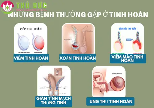 tong-hop-nhung-benh-thuong-gap-o-tinh-hoan-va-cach-xu-ly-1254