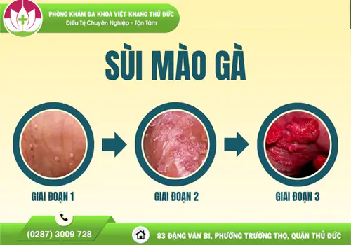 Việt Khang Thủ Đức