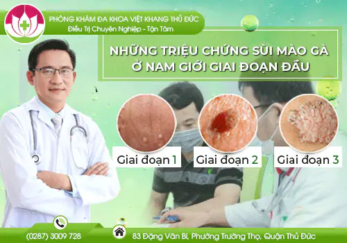 nhung-trieu-chung-sui-mao-ga-o-nam-gioi-giai-doan-dau-695