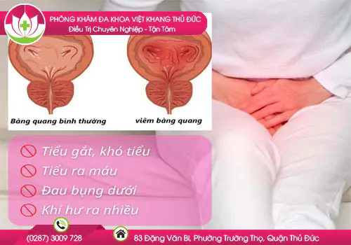 viem-bang-quang-xuat-huyet-nguyen-nhan-trieu-chung-chan-doan-dieu-tri-155