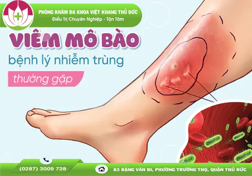 viem-mo-te-bao-benh-ly-nguy-hiem-cho-xem-thuong-1841
