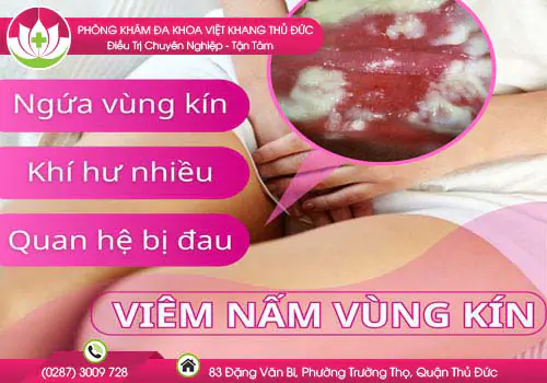trieu-chung-viem-nam-am-dao-o-nu-gioi-153