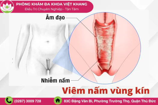 Việt Khang Thủ Đức
