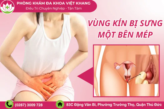 nguyen-nhan-vung-kin-bi-sung-mot-ben-mep-cach-dieu-tri-giam-sung-nhanh-1308