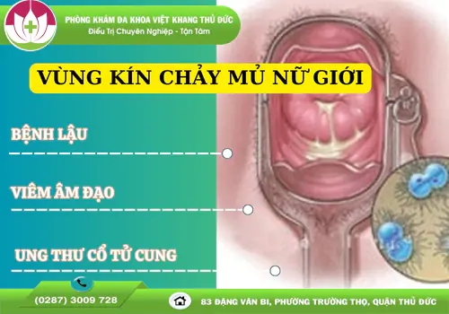 vung-kin-chay-mu-o-nam-va-nu-dau-hieu-benh-ly-can-biet-1500