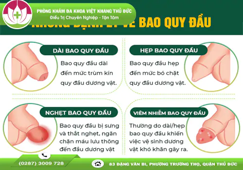 xem-ngay-cac-benh-ve-bao-quy-dau-thuong-gap-o-nam-khoa-1574