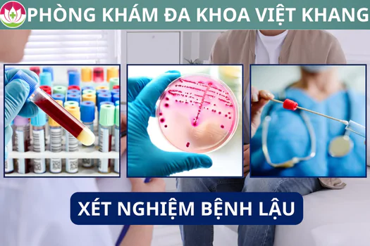 xet-nghiem-benh-lau-o-dau-cho-ket-qua-nhanh-va-chinh-xac-1270
