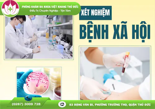 xet-nghiem-benh-xa-hoi-phat-hien-som-bao-ve-suc-khoe-lau-dai-1329
