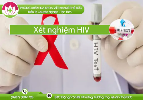 cac-phuong-phap-xet-nghiem-hiv-797