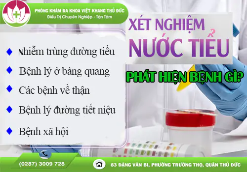 xet-nghiem-nuoc-tieu-phat-hien-benh-gi-1993